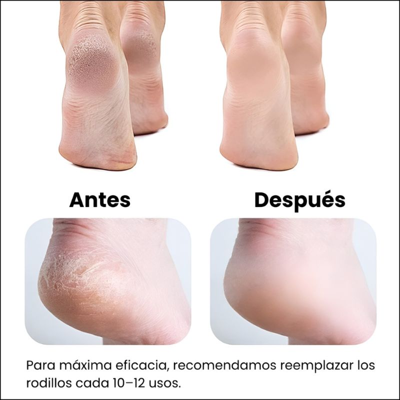 Lima De Pies Eléctrica Profesional Para Eliminar Callosidades Y Piel Muerta