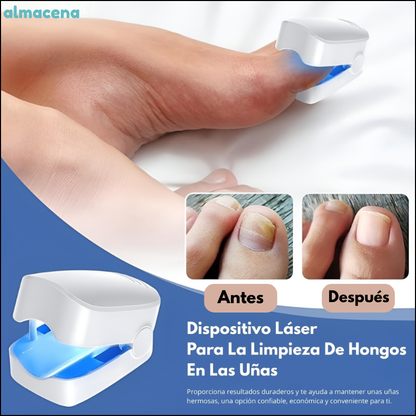 Dispositivo Láser Para Uñas Para Tratar Tus Uñas En Solo 7 Minutos Al Día